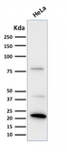Anti-Ferritin Light Chain antibody [FTL/1388] used in Western Blot (WB). GTX34723