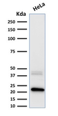 Anti-Ferritin Light Chain antibody [FTL/1389] used in Western Blot (WB). GTX34724