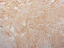 Anti-Fibronectin antibody [HFN7.1] used in IHC (Paraffin sections) (IHC-P). GTX34725