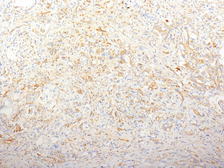 Anti-Fibronectin antibody [TV-1] used in IHC (Paraffin sections) (IHC-P). GTX34727