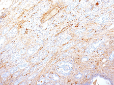 Anti-Fibronectin antibody [SPM246] used in IHC (Paraffin sections) (IHC-P). GTX34728