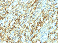 Anti-Fibronectin antibody [568] used in IHC (Paraffin sections) (IHC-P). GTX34730