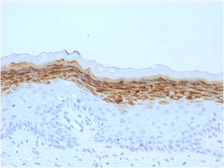 Anti-Filaggrin antibody [FLG/1561] used in IHC (Paraffin sections) (IHC-P). GTX34731
