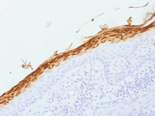 Anti-Filaggrin antibody [FLG/1562] used in IHC (Paraffin sections) (IHC-P). GTX34733
