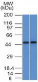 Anti-FLI1 antibody [FLI1/1312] used in Western Blot (WB). GTX34734