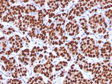 Anti-FOXA1 antibody [FOXA1/1512] used in IHC (Paraffin sections) (IHC-P). GTX34736