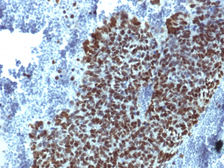 Anti-FOXA1 antibody [FOXA1/1514] used in IHC (Paraffin sections) (IHC-P). GTX34737