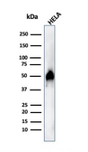 Anti-FOXA1 antibody [FOXA1/1515] used in Western Blot (WB). GTX34738