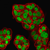 Anti-FOXA1 antibody [FOXA1/1519] used in Immunocytochemistry/ Immunofluorescence (ICC/IF). GTX34740