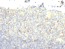 Anti-FOXP3 antibody [FXP3/197] used in IHC (Paraffin sections) (IHC-P). GTX34741