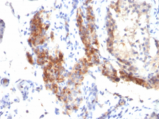 Anti-FOXP3 antibody [SPM579] used in IHC (Paraffin sections) (IHC-P). GTX34742