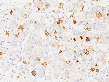 Anti-FSH beta antibody [SPM107] used in IHC (Paraffin sections) (IHC-P). GTX34744