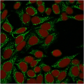 Anti-Galectin 1 antibody [GAL1/1831] used in Immunocytochemistry/ Immunofluorescence (ICC/IF). GTX34746