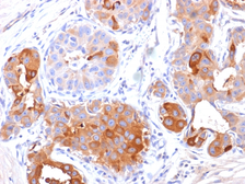 Anti-GCDFP15 antibody [PIP/1571] used in IHC (Paraffin sections) (IHC-P). GTX34753