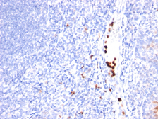 Anti-G-CSF antibody [SPM468] used in IHC (Paraffin sections) (IHC-P). GTX34755