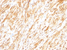 Anti-GFAP antibody [SPM248] used in IHC (Paraffin sections) (IHC-P). GTX34756