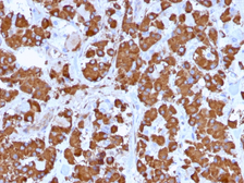 Anti-Growth Hormone antibody [GH/1371] used in IHC (Paraffin sections) (IHC-P). GTX34768