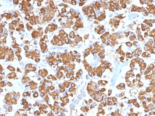Anti-Growth Hormone antibody [GH/1450] used in IHC (Paraffin sections) (IHC-P). GTX34769