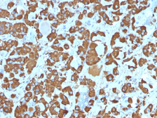 Anti-Growth Hormone antibody [SPM106] used in IHC (Paraffin sections) (IHC-P). GTX34770