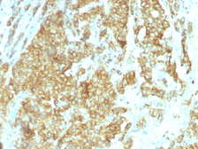 Anti-GRP94 antibody [HSP90B1/1192] used in IHC (Paraffin sections) (IHC-P). GTX34773