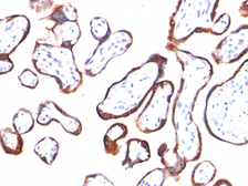 Anti-hCG beta antibody [HCGb/54] used in IHC (Paraffin sections) (IHC-P). GTX34776