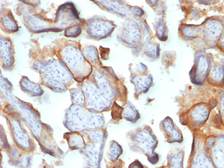 Anti-hCG beta antibody [SPM105] used in IHC (Paraffin sections) (IHC-P). GTX34777