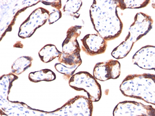 Anti-hCG beta antibody [HCGb/459] used in IHC (Paraffin sections) (IHC-P). GTX34778