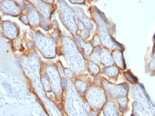 Anti-hCG beta antibody [SPM529] used in IHC (Paraffin sections) (IHC-P). GTX34779