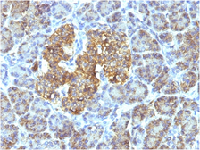 Anti-HSP60 antibody [SPM253] used in IHC (Paraffin sections) (IHC-P). GTX34786