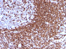 Anti-ICAM3 antibody [186-2G9] used in IHC (Paraffin sections) (IHC-P). GTX34789