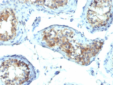 Anti-Interferon gamma antibody [IFNG/466] used in IHC (Paraffin sections) (IHC-P). GTX34794