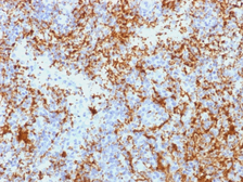 Anti-Integrin beta 3 antibody [Y2/51] used in IHC (Paraffin sections) (IHC-P). GTX34801