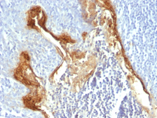 Anti-Involucrin antibody [IVRN/827] used in IHC (Paraffin sections) (IHC-P). GTX34803