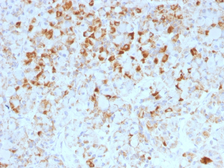 Anti-LH beta antibody [LHb/1214] used in IHC (Paraffin sections) (IHC-P). GTX34807