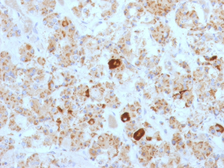 Anti-LH beta antibody [SPM103] used in IHC (Paraffin sections) (IHC-P). GTX34808