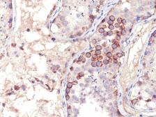 Anti-MAGE 1 antibody [MA454] used in IHC (Paraffin sections) (IHC-P). GTX34809