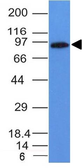 Anti-MALT1 antibody [MT1/410] used in Western Blot (WB). GTX34812