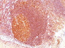 Anti-MALT1 antibody [SPM578] used in IHC (Paraffin sections) (IHC-P). GTX34813