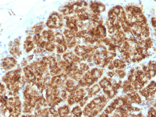 Anti-MAML2 antibody [MAML2/1302] used in IHC (Paraffin sections) (IHC-P). GTX34814