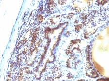 Anti-MAP3K1 antibody [2F6] used in IHC (Paraffin sections) (IHC-P). GTX34816