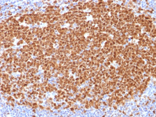 Anti-MCM7 antibody [MCM7/1468] used in IHC (Paraffin sections) (IHC-P). GTX34819