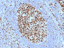 Anti-MCM7 antibody [SPM379] used in IHC (Paraffin sections) (IHC-P). GTX34821
