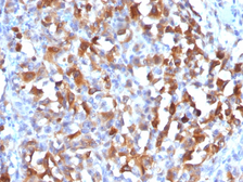 Anti-Melan A antibody used in IHC (Paraffin sections) (IHC-P). GTX34822