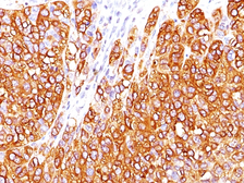 Anti-Melan A antibody [M2-7C10] used in IHC (Paraffin sections) (IHC-P). GTX34823