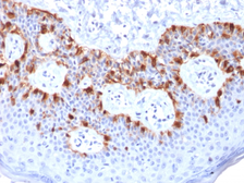 Anti-Melan A antibody [rMLANA/788] used in IHC (Paraffin sections) (IHC-P). GTX34824