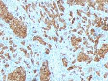 Anti-Melan A antibody [SPM342] used in IHC (Paraffin sections) (IHC-P). GTX34825