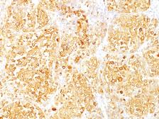Anti-Melan A antibody [M2-9E3] used in IHC (Paraffin sections) (IHC-P). GTX34826