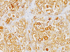 Anti-Melan A antibody [M2-9E3] used in IHC (Paraffin sections) (IHC-P). GTX34826