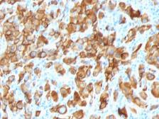 Anti-Melan A antibody [SPM540] used in IHC (Paraffin sections) (IHC-P). GTX34827