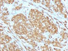 Anti-Melan A antibody [SPM555] used in IHC (Paraffin sections) (IHC-P). GTX34828